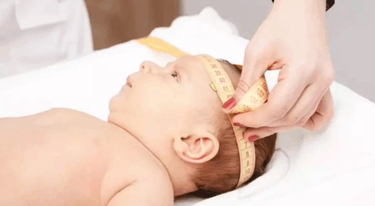 Image hydrocephalus w alpha