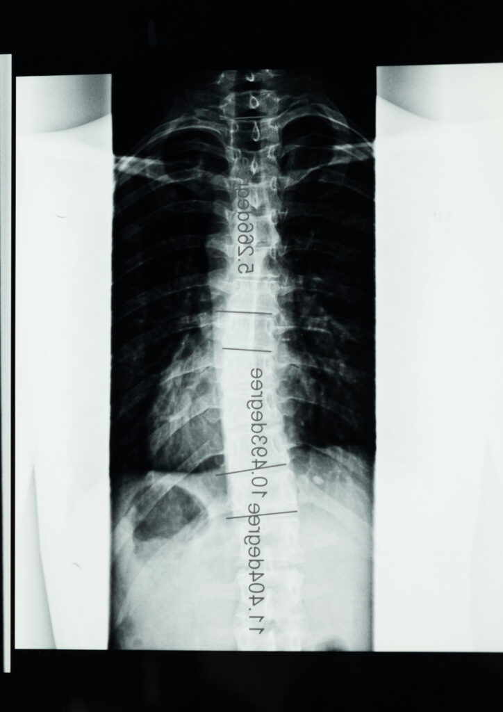 pexels cottonbro 5723884   Edited